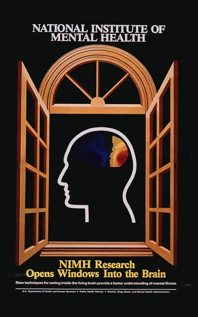 NIMH research opens windows into the brain by National Institutes of Health — digital art print download