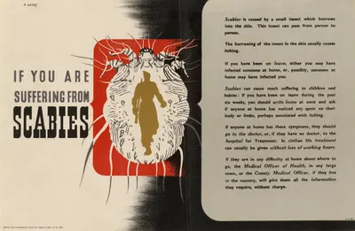 If You are Suffering from Scabies by Abram Games — digital art print download