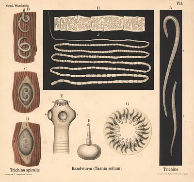 Trichina spiralis. Bandwurm (Taenia solium). Trichine by Julius Klinkhardt, 1911 — digital art print download