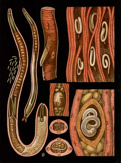 Trichinella spiralis by Gottlieb von Koch, 1910 — digital art print download