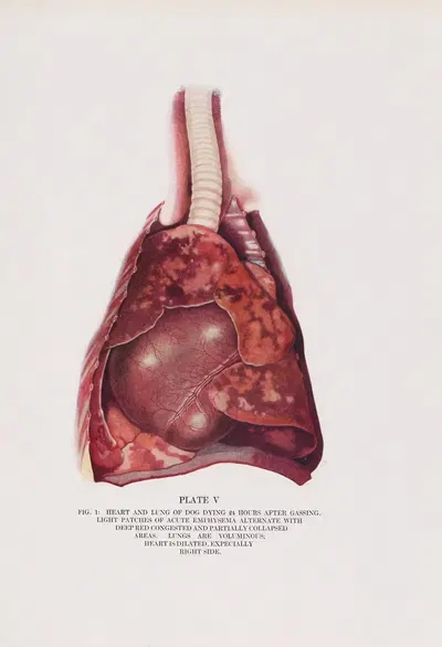 Plate V (Fig. 1): Heart and lung of dog dying 24 hours after gassing. by Milton C. Winternitz, 1920 — digital art print…