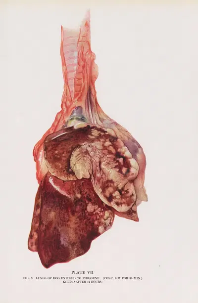 Plate VII (Fig. 3): Lungs of dog exposed to phosgene. by Milton C. Winternitz, 1920 — digital art print download