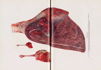 Plate XVI (Fig. 1): Lungs of goat, monkey, and rat surviving, respectively, 4 hours and 10 minutes, 4 hours and 55 minutes,…