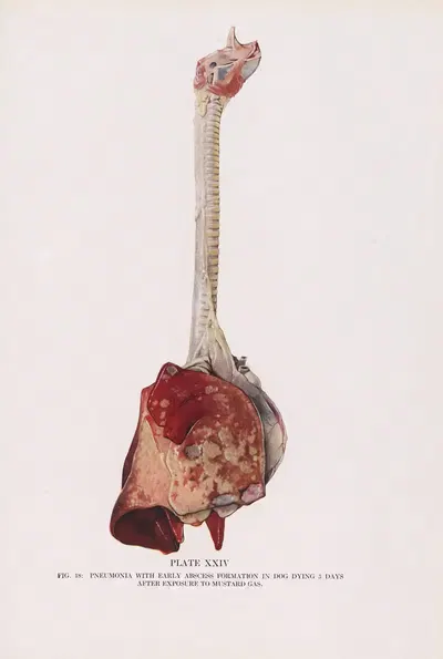 Plate XXIV (Fig. 18): Pneumonia with early abscess formation in dog dying 5 days after exposure to mustard gas. by Milton…
