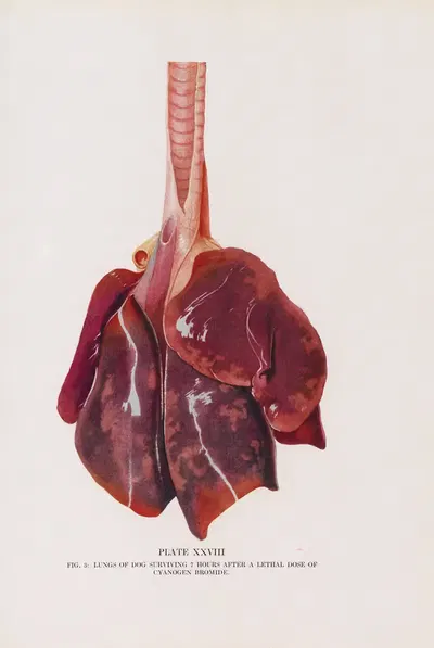 Plate XXVIII (Fig. 3): Lungs of dog surviving 7 hours after a lethal dose of cyanogen bromide. by Milton C. Winternitz,…