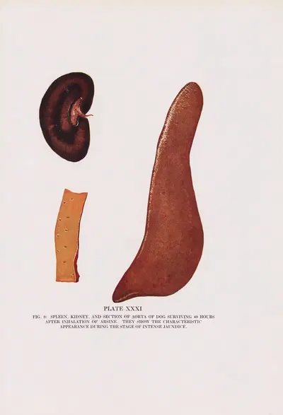 Plate XXXI (Fig. 3): Spleen, kidney, and section of aorta of dog surviving 49 hours after inhalation of arsine. by Milton…
