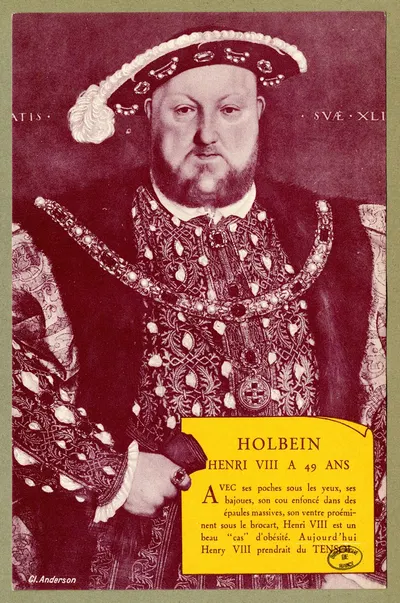 Holbein ; Henri VIII à 49 ans by Laboratoire d'actino-biologie, 1910-1950 — digital art print download