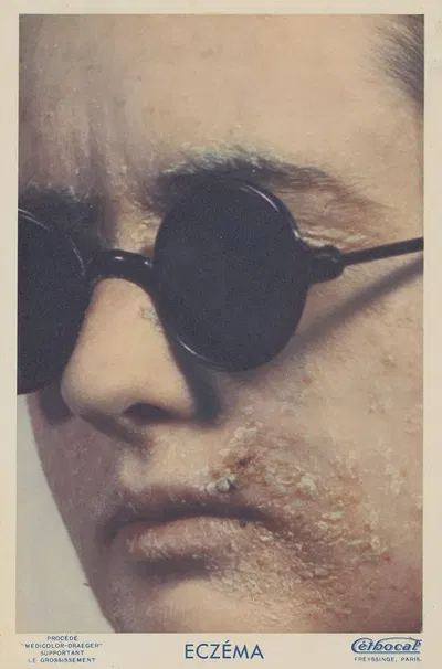 Céthocal by Laboratoire Freyssinge, 1910-1950 — digital art print download