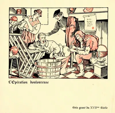 L'opération douloureuse by Bénic — digital art print download