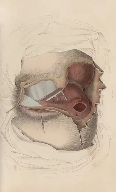 A system of anatomical plates of the human body Pl.095 by John Lizars, 1840 — digital art print download