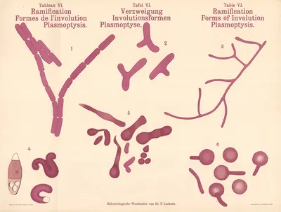 Ramification Forms of Involution Plasmoptysis by Hans Ernst August Buchner — digital art print download