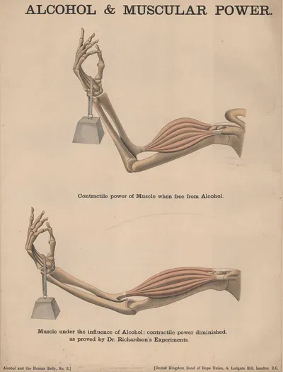 Alcohol and Muscular Power by Charles Wakely, 1890 — digital art print download
