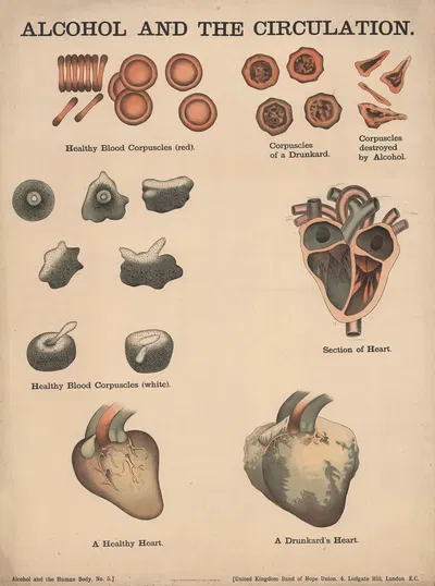 Alcohol and the Circulation by Charles Wakely, 1890 — digital art print download