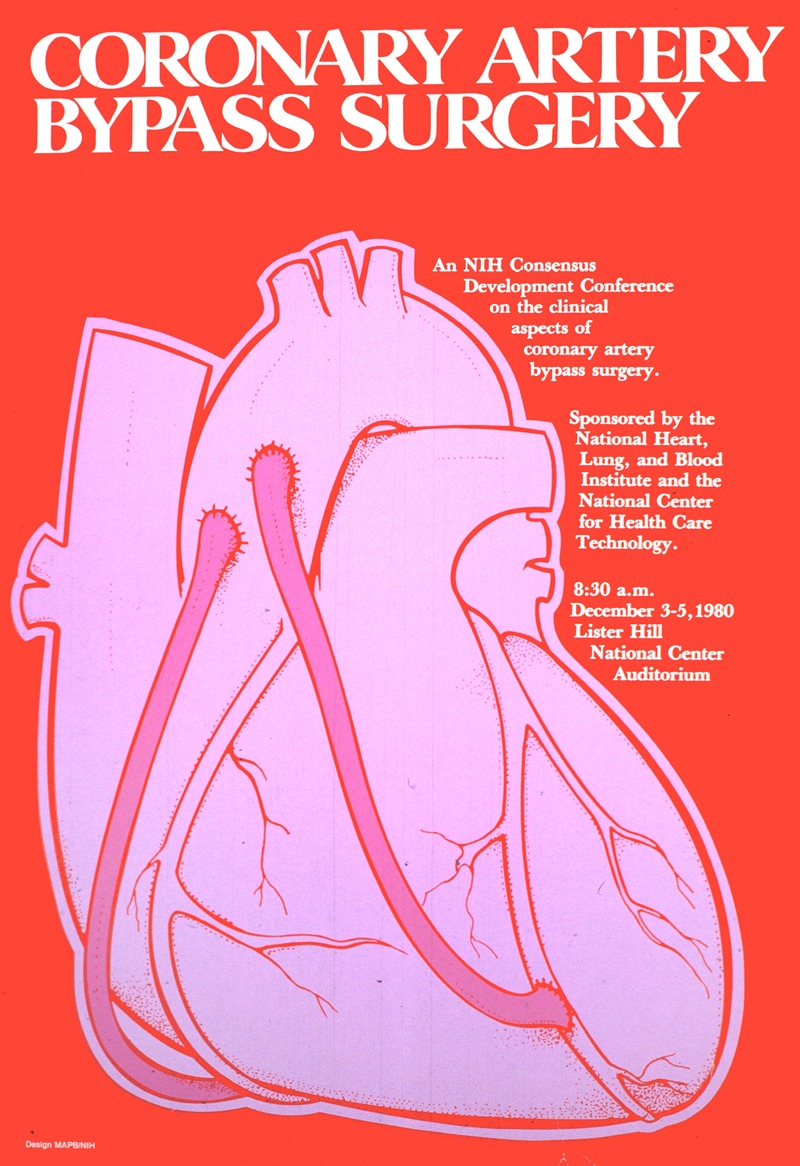 Coronary artery bypass surgery by National Institutes of Health, 1980 — digital art print download