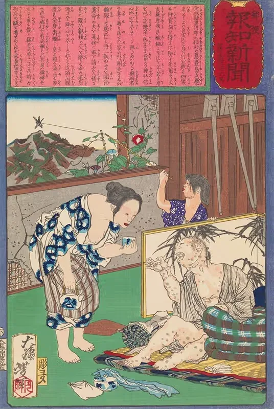 Toshima Tomiyo Who Stayed with Her Leper Husband, Tomozō — Tsukioka Yoshitoshi
