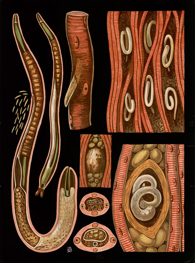 Trichinella spiralis by Gottlieb von Koch, 1910 — digital art print download