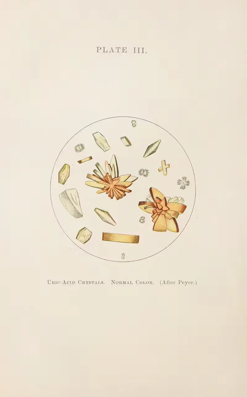 Plate III: Uric-Acid Crystals (Normal Color) — Charles Wesley Purdy