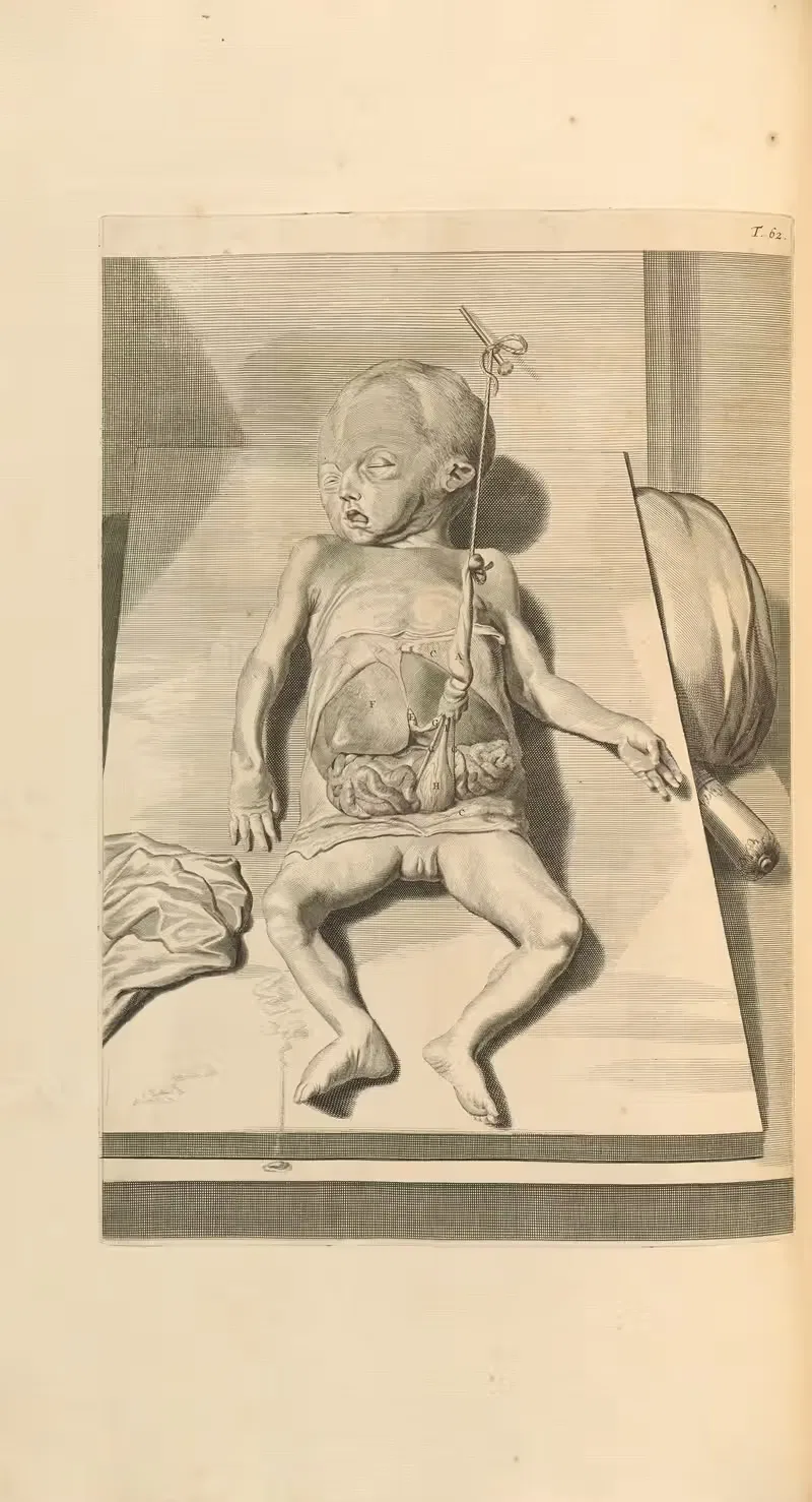 Anatomia humani corporis Pl.063 — Gerard de Lairesse