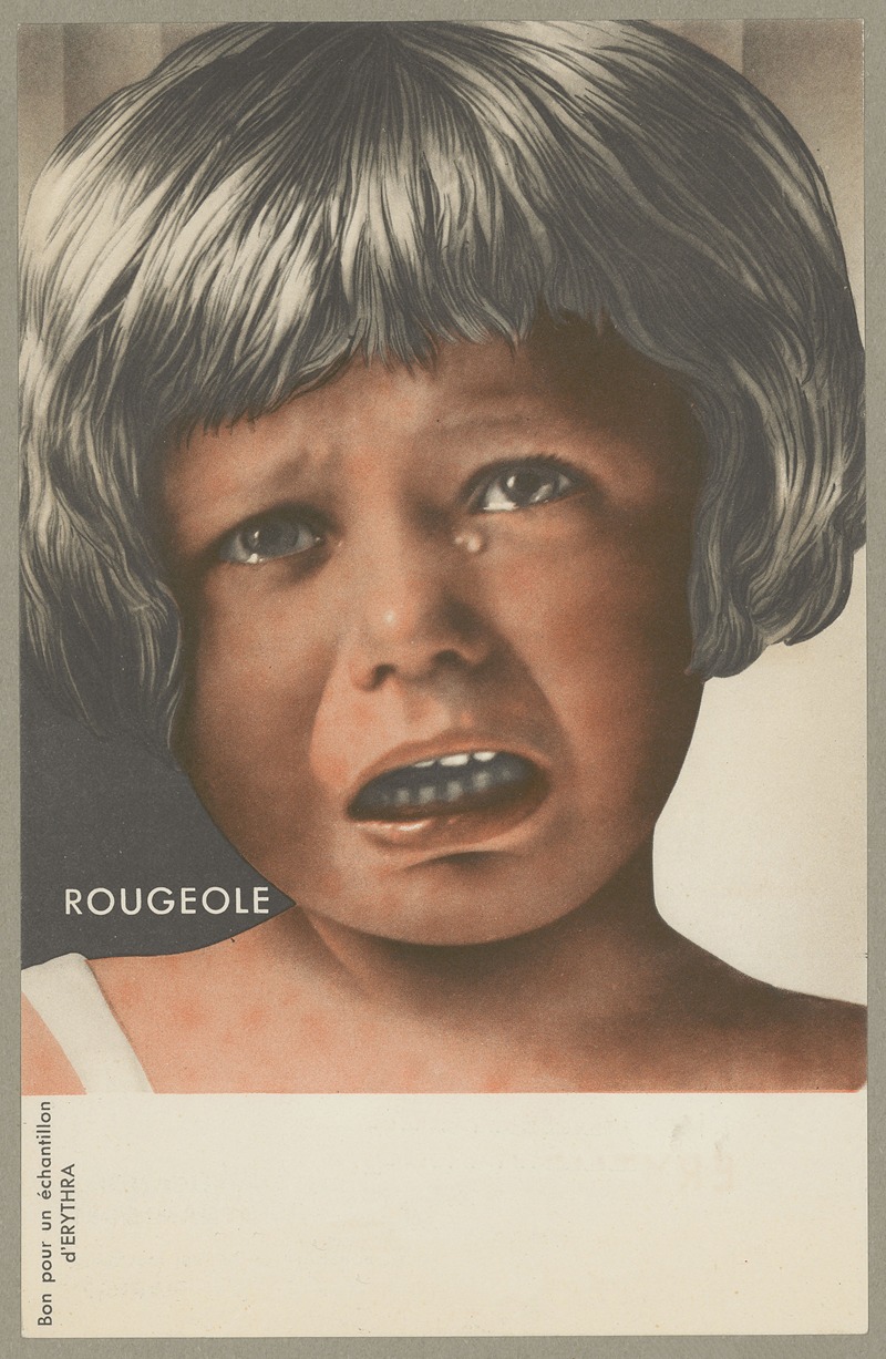 Rougeole (Erythra) by Société d'applications pharmacodynamiques, 1936 — digital art print download