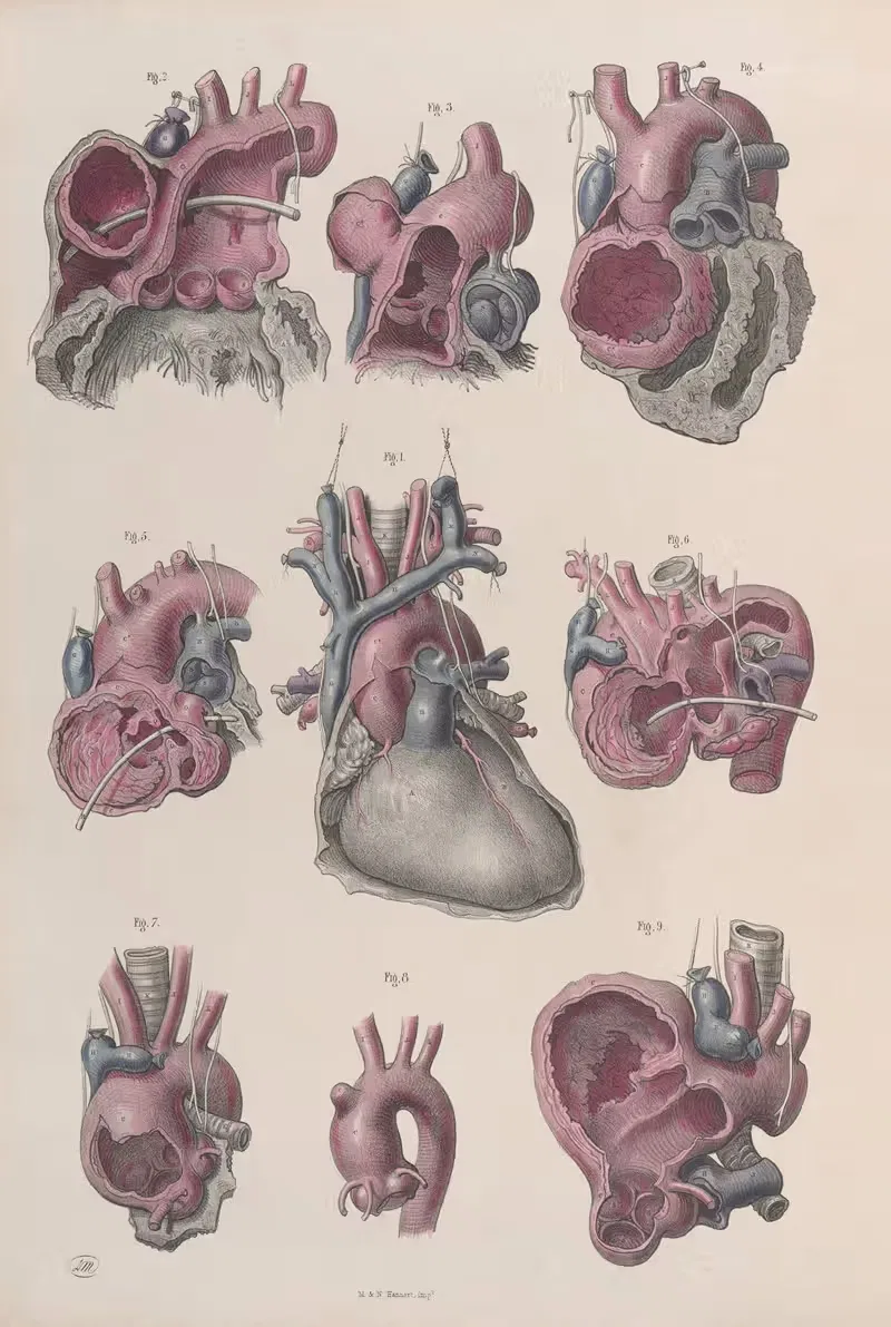 Хирургическая анатомия, пл. 14 by Жозеф Макиллис, 1856 — digital art print download