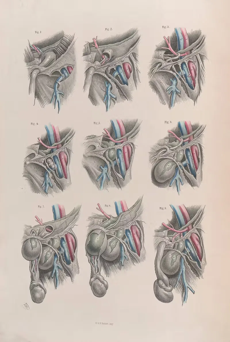 Хирургическая анатомия Pl.38 by Жозеф Макиллис, 1856 — digital art print download