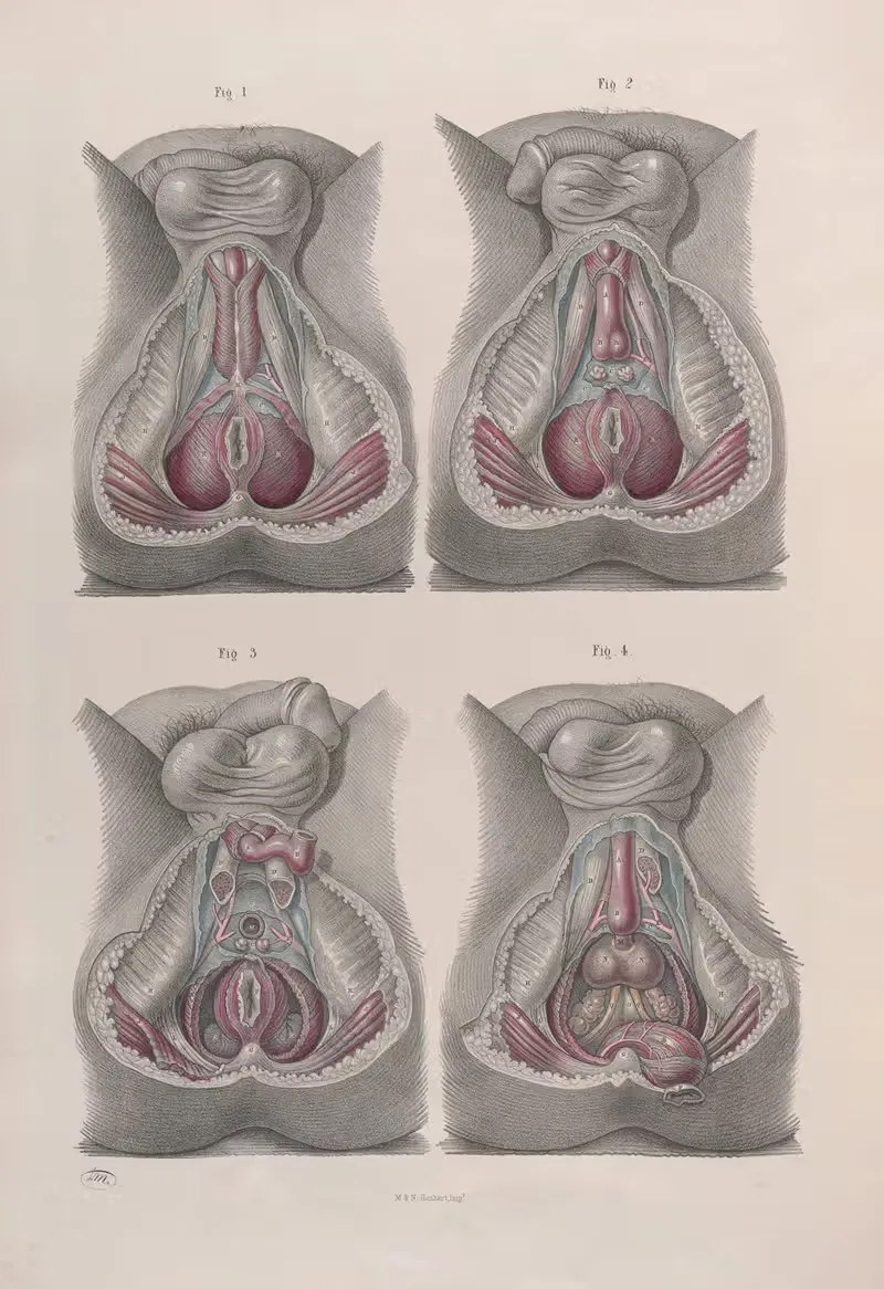 Хирургическая анатомия Пл.43 by Жозеф Макиллис, 1856 — digital art print download