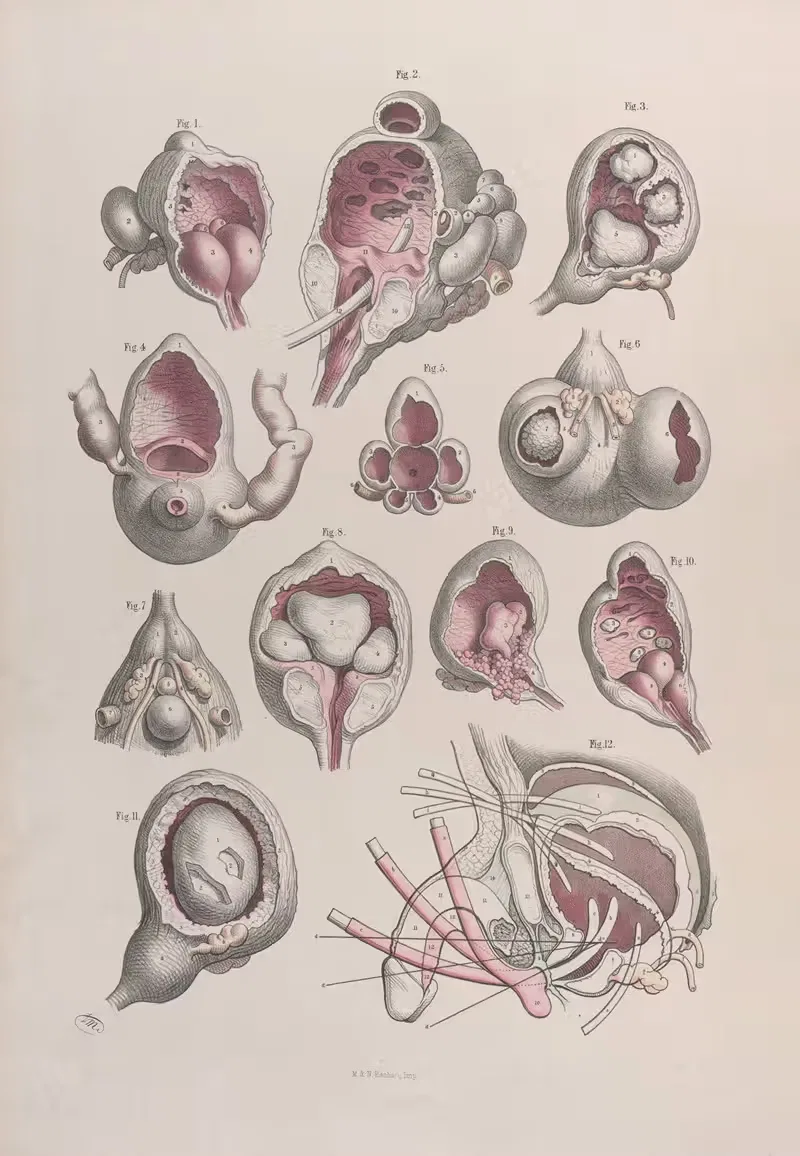 Хирургическая анатомия Пл.47 by Жозеф Макиллис, 1856 — digital art print download