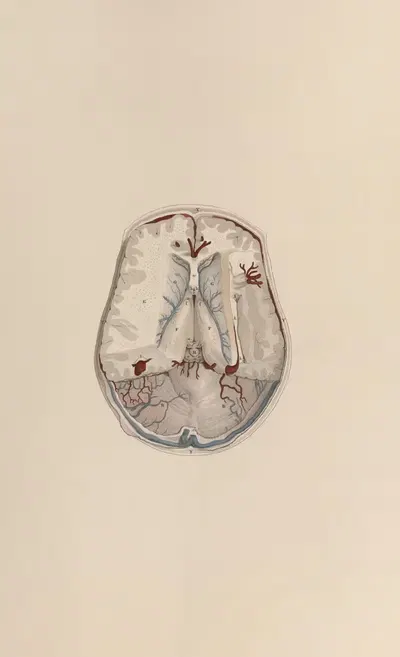 A system of anatomical plates of the human body Pl.066 by John Lizars, 1840 — digital art print download