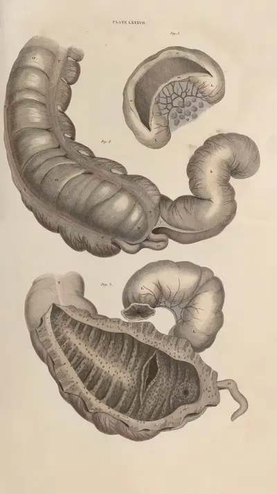 A system of anatomical plates of the human body Pl.090 by John Lizars, 1840 — digital art print download