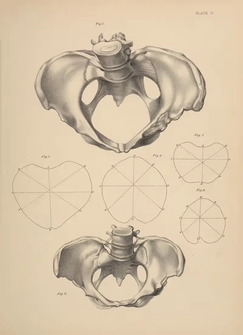 Malformation of the Pelvis — Frank Horace Getchell