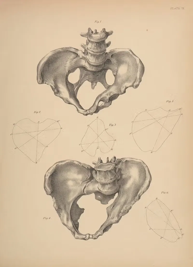 Malformation of the Pelvis — Frank Horace Getchell