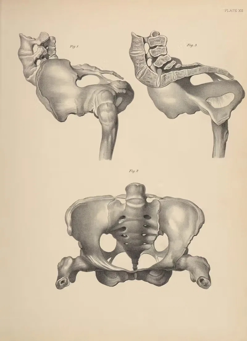 Malformations of the Pelvis — Frank Horace Getchell