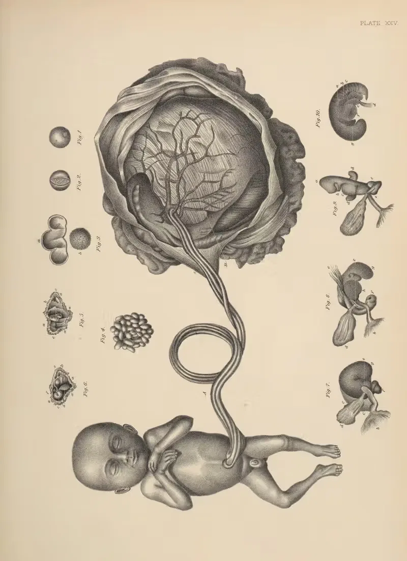 A Foetus of about three months, with its Appendages — Frank Horace Getchell