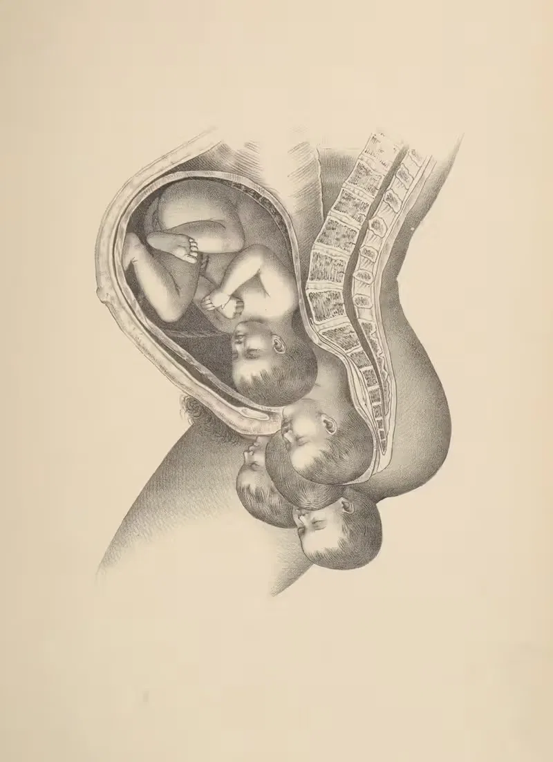 Fronto-anterior Termination of the Third Position — Frank Horace Getchell
