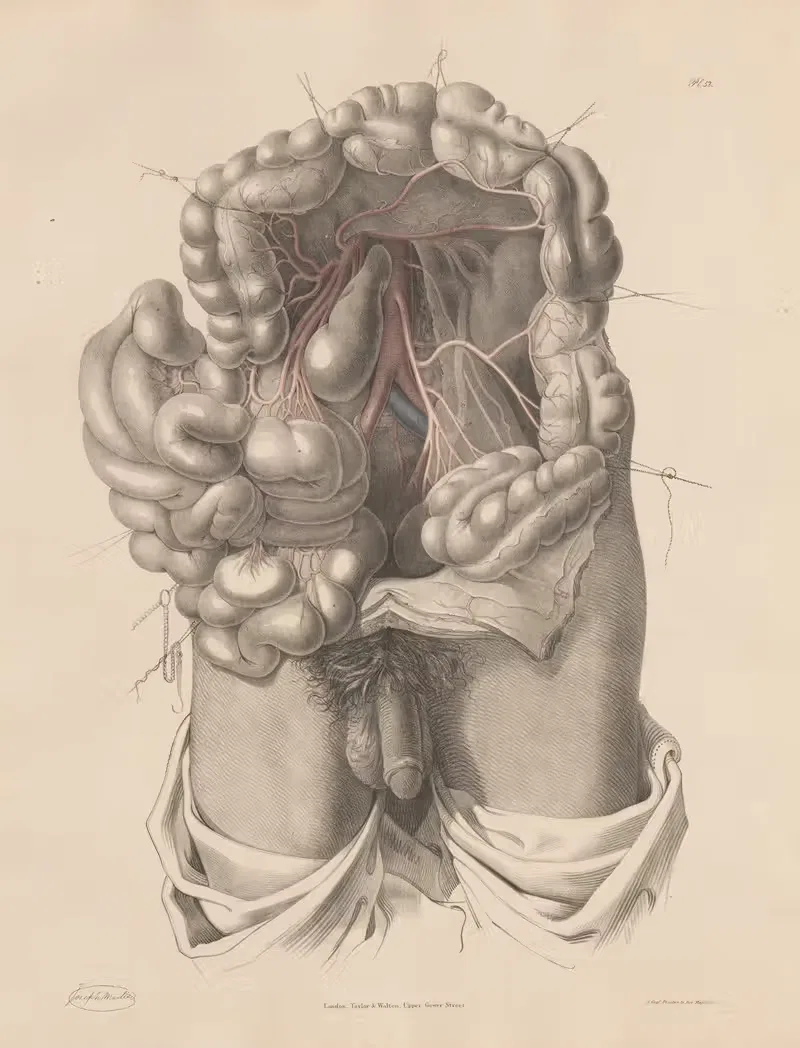 The Inferior Mesenteric artery and its branches — Joseph Maclise