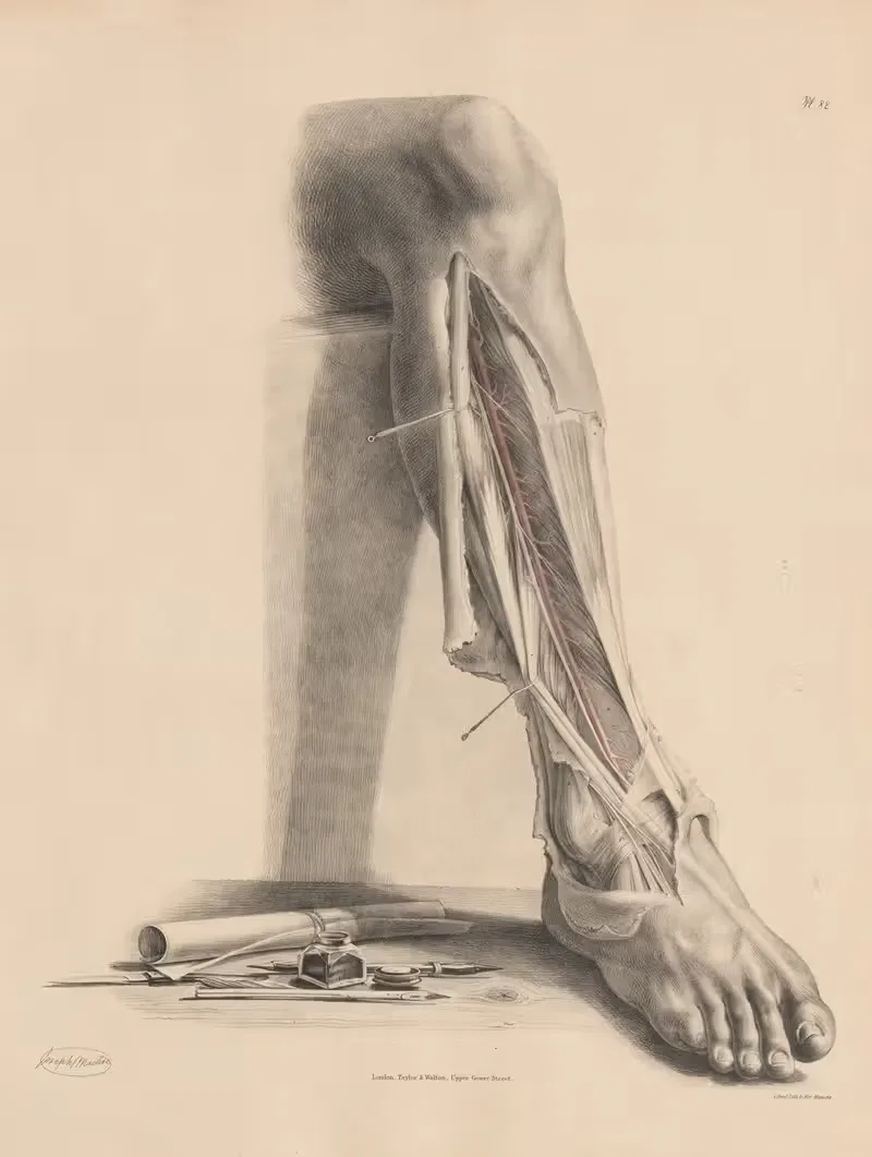 The Anterior Tibial artery — Joseph Maclise